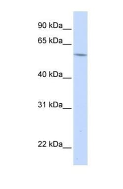 alpha 1B-Glycoprotein Antibody, Novus Biologicals 100 ul; Unconjugated:Antibodies,