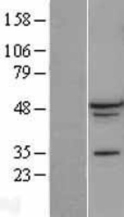 Novus Biologicals&trade;&nbsp;A2BP1 Overexpression Lysate