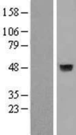 Novus Biologicals&trade;&nbsp;A4GNT Overexpression Lysate