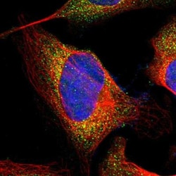 A4GNT Antibody, Novus Biologicals:Antibodies:Primary Antibodies