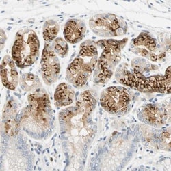 A4GNT Antibody, Novus Biologicals:Antibodies:Primary Antibodies