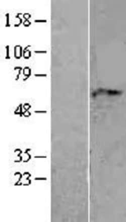Novus Biologicals&trade;&nbsp;AAAS Overexpression Lysate