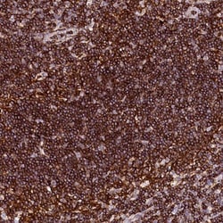 AAAS Antibody, Novus Biologicals 25 &mu;L; Unlabeled:Antibodies, Polyclonal