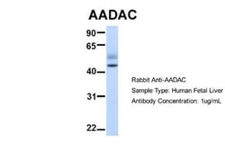 AADAC Antibody, Novus Biologicals 100&mu;L; Unlabeled:Antibodies, Polyclonal