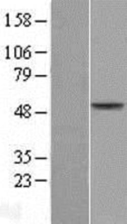Novus Biologicals™ AADAC Overexpression Lysate