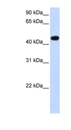 AADAC Antibody, Novus Biologicals 100&mu;L; Unlabeled:Antibodies, Polyclonal