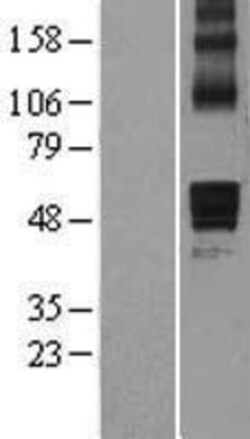 Novus Biologicals&trade;&nbsp;AADACL1 Overexpression Lysate