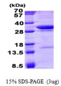 Novus Biologicals&trade;&nbsp;Recombinant Human AADACL1 His Protein