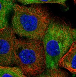 AADACL1 Antibody, Novus Biologicals:Antibodies:Primary Antibodies