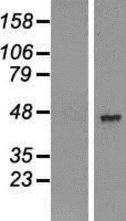 Novus Biologicals&trade;&nbsp;AADACL2 Overexpression Lysate