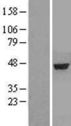Novus Biologicals™ alpha-Aminoadipate Aminotransferase Overexpression Lysate