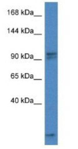 AAK1 Antibody, Novus Biologicals 100&mu;L; Unlabeled:Antibodies, Polyclonal