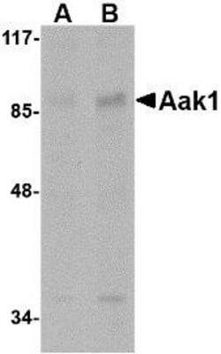 AAK1 Antibody - BSA Free, Novus Biologicals:Antibodies:Primary Antibodies