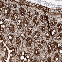 AARS2 Antibody, Novus Biologicals 0.1mL; Unlabeled:Antibodies, Polyclonal