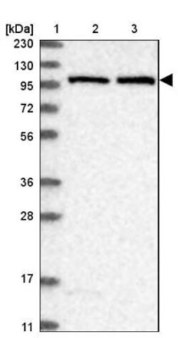 AARS2 Antibody, Novus Biologicals 0.1mL; Unlabeled:Antibodies, Polyclonal