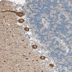 PTGES3L-AARSD1 Antibody, Novus Biologicals 0.1mL; Unlabeled:Antibodies,