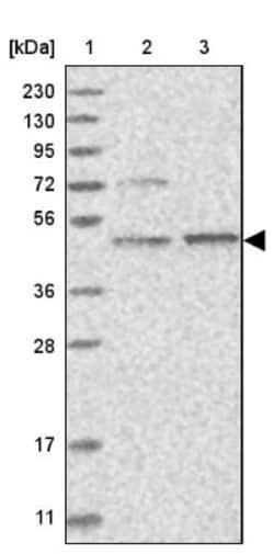 AARSD1 Antibody, Novus Biologicals 0.1mL; Unlabeled:Antibodies, Polyclonal