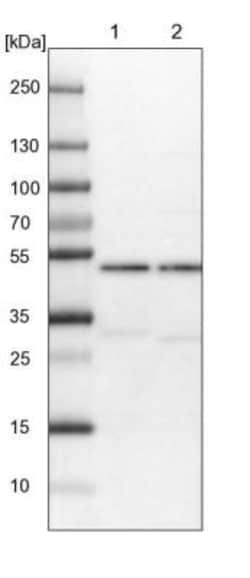AARSD1 Antibody, Novus Biologicals 0.1mL; Unlabeled:Antibodies, Polyclonal