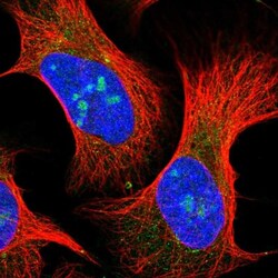 AASDH Antibody, Novus Biologicals 25 &mu;L; Unlabeled:Antibodies, Polyclonal