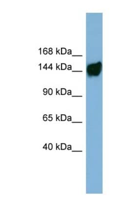 AASDH Antibody, Novus Biologicals 100&mu;L; Unlabeled:Antibodies, Polyclonal