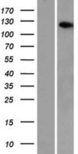 Novus Biologicals&trade;&nbsp;AASDH Overexpression Lysate