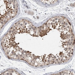 AASD-PPT Antibody, Novus Biologicals 0.1mL; Unlabeled:Antibodies, Polyclonal