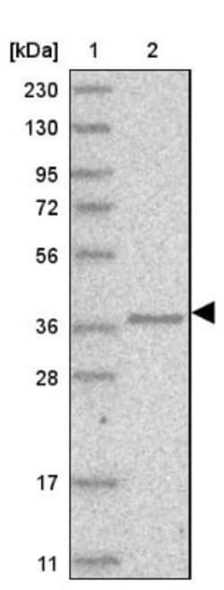 AASD-PPT Antibody, Novus Biologicals 0.1mL; Unlabeled:Antibodies, Polyclonal