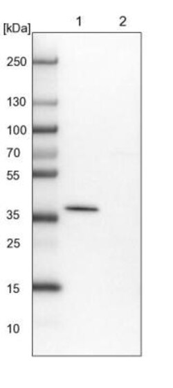 AASD-PPT Antibody, Novus Biologicals 0.1mL; Unlabeled:Antibodies, Polyclonal