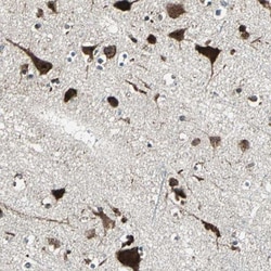 AATF Antibody, Novus Biologicals 0.1mL; Unlabeled:Antibodies, Polyclonal