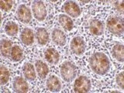 AATF Antibody - BSA Free, Novus Biologicals 0.1mg; Unlabeled:Antibodies,