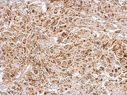 ABAT Antibody, Novus Biologicals 0.1mL; Unlabeled:Antibodies, Polyclonal