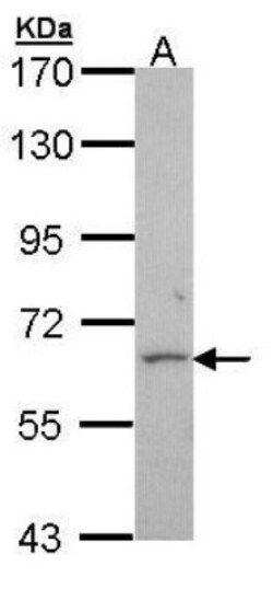 ABAT Antibody, Novus Biologicals 0.1 mL | Buy Online | Novus Biologicals | Fisher Scientific