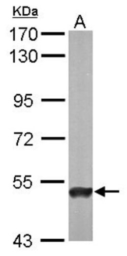 ABAT Antibody, Novus Biologicals 0.1 mL | Buy Online | Novus Biologicals | Fisher Scientific