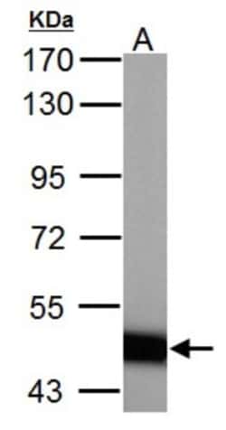 ABAT Antibody, Novus Biologicals 0.1 mL | Buy Online | Novus Biologicals | Fisher Scientific