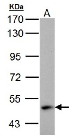 ABAT Antibody, Novus Biologicals 0.1mL; Unlabeled:Antibodies, Polyclonal