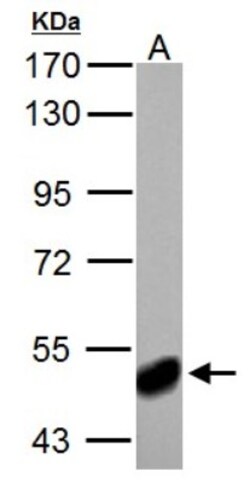 ABAT Antibody, Novus Biologicals 0.1mL; Unlabeled:Antibodies, Polyclonal