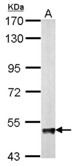 ABAT Antibody, Novus Biologicals 0.1mL; Unlabeled:Antibodies, Polyclonal