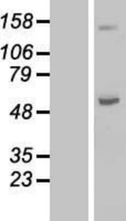 Novus Biologicals™ ABAT Overexpression Lysate