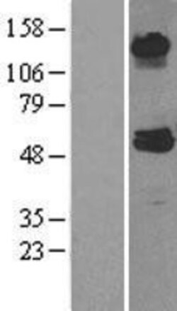 Novus Biologicals&trade;&nbsp;ABAT Overexpression Lysate