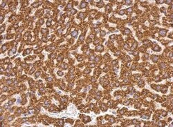 ABAT Antibody, Novus Biologicals 0.1mL; Unlabeled:Antibodies, Polyclonal