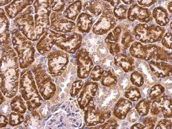 ABAT Antibody, Novus Biologicals 0.1mL; Unlabeled:Antibodies, Polyclonal