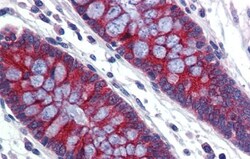 ABCA5 Antibody, Novus Biologicals 20&mu;L; Unlabeled:Antibodies, Polyclonal