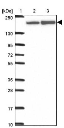 ABCA9 Antibody, Novus Biologicals 0.1mL; Unlabeled:Antibodies, Polyclonal