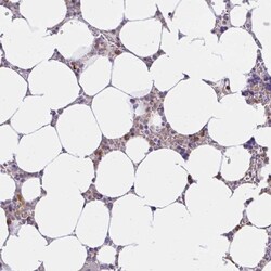 ABCB10 Antibody, Novus Biologicals:Antibodies:Primary Antibodies