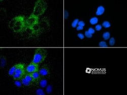 ABCB5 Antibody - BSA Free, Novus Biologicals 0.1mL; Unlabeled:Antibodies,