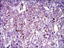 ABCB5 Antibody (5H3C6) - BSA Free, Novus Biologicals 0.1mL; Unlabeled:Antibodies,