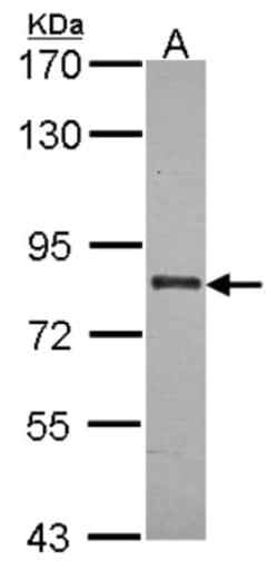 ABCB7 Antibody, Novus Biologicals 0.1mL; Unlabeled:Antibodies, Polyclonal
