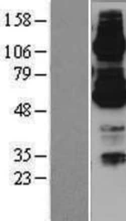 Novus Biologicals&trade;&nbsp;ABCB7 Overexpression Lysate