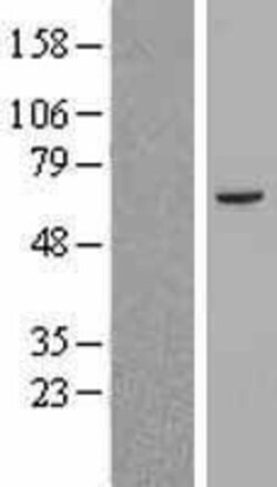 Novus Biologicals™ ABCB8 Overexpression Lysate