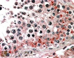 ABCB9 Antibody, Novus Biologicals 0.1mg; Unlabeled:Antibodies, Polyclonal